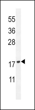 PLA2G2D Antibody in Western Blot (WB)
