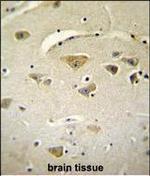 VSTM2A Polyclonal Antibody