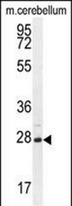 VSTM2A Antibody in Western Blot (WB)