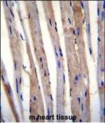 KRT73 Polyclonal Antibody