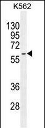 KRT73 Antibody in Western Blot (WB)