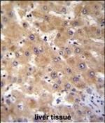 GAGE12B Polyclonal Antibody