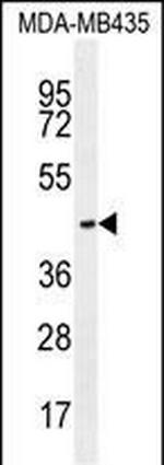 OR2L13 Polyclonal Antibody