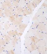 CLEC4F Polyclonal Antibody