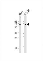 CLEC4F Antibody in Western Blot (WB)