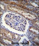 ARL5B Polyclonal Antibody
