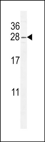 ARL5B Antibody in Western Blot (WB)