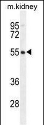 FBXO47 Antibody in Western Blot (WB)
