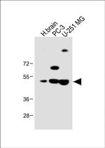 AP1M1 Antibody in Western Blot (WB)