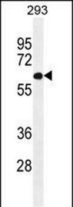 PATL2 Antibody in Western Blot (WB)