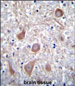 PTCHD1 Polyclonal Antibody