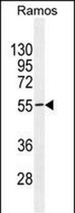 TSGA10IP Antibody in Western Blot (WB)