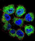 GTF2H2C Polyclonal Antibody