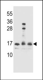 HOPX Polyclonal Antibody