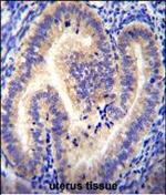 CCDC54 Antibody in Immunohistochemistry (Paraffin) (IHC (P))