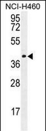 CCDC54 Antibody in Western Blot (WB)