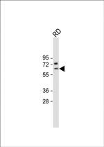 SMTNL1 Antibody in Western Blot (WB)