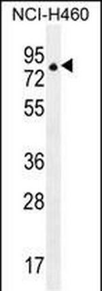 ZNF28 Polyclonal Antibody