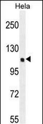 SIK3 Polyclonal Antibody