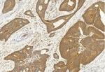 SASH1 Antibody in Immunohistochemistry (Paraffin) (IHC (P))