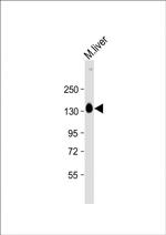 SASH1 Antibody in Western Blot (WB)