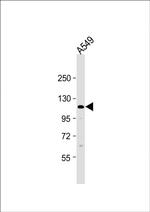 ECT2L Antibody in Western Blot (WB)