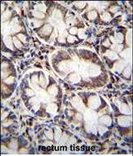 CACNG8 Polyclonal Antibody