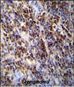 PARP9 Polyclonal Antibody