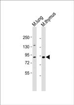 PARP9 Antibody in Western Blot (WB)