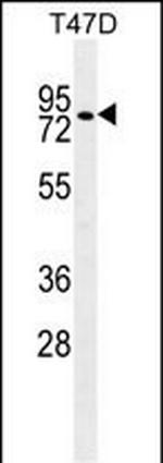 ZNF69 Polyclonal Antibody