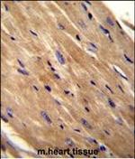 RhoJ Antibody in Immunohistochemistry (Paraffin) (IHC (P))