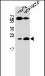 RhoJ Antibody in Western Blot (WB)