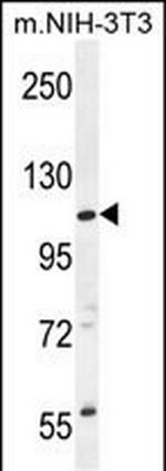 CCDC158 Polyclonal Antibody