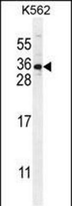 STARD6 Polyclonal Antibody