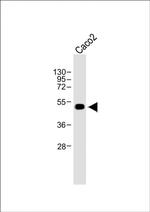 WTIP Antibody in Western Blot (WB)