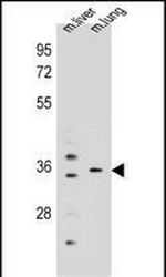 KCNRG Antibody in Western Blot (WB)
