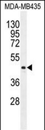 LIPK Polyclonal Antibody