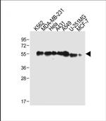 TUBB6 Polyclonal Antibody