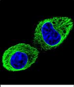 TUBB2B Polyclonal Antibody