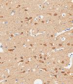 TUBB2B Antibody in Immunohistochemistry (Paraffin) (IHC (P))