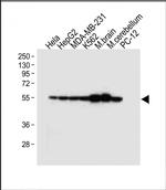 TUBB2B Antibody in Western Blot (WB)