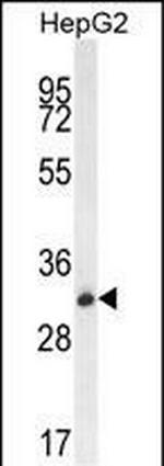 OR4K5 Polyclonal Antibody