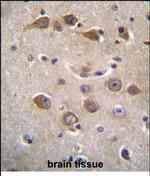 RAB40AL Polyclonal Antibody