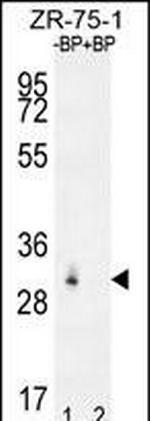 RAB40AL Antibody in Western Blot (WB)