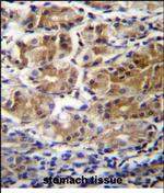 PDPR Polyclonal Antibody