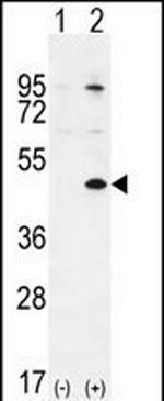 TGIF Polyclonal Antibody