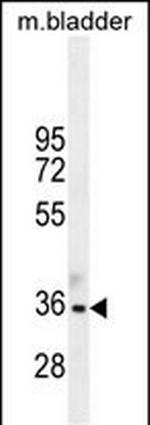 TGIF Antibody in Western Blot (WB)