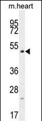 TSPYL4 Polyclonal Antibody