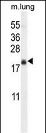 TMEM80 Polyclonal Antibody