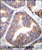 FAM109A Polyclonal Antibody